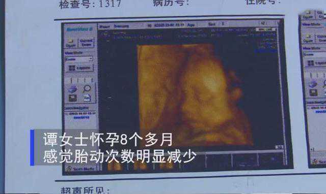 上海借卵自孕成功率，怀孕38周胎死腹中，孕期胎儿三种求救信号，孕妈要及时