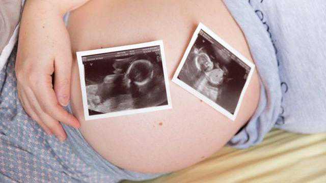 上海借卵自孕成功率，怀孕38周胎死腹中，孕期胎儿三种求救信号，孕妈要及时
